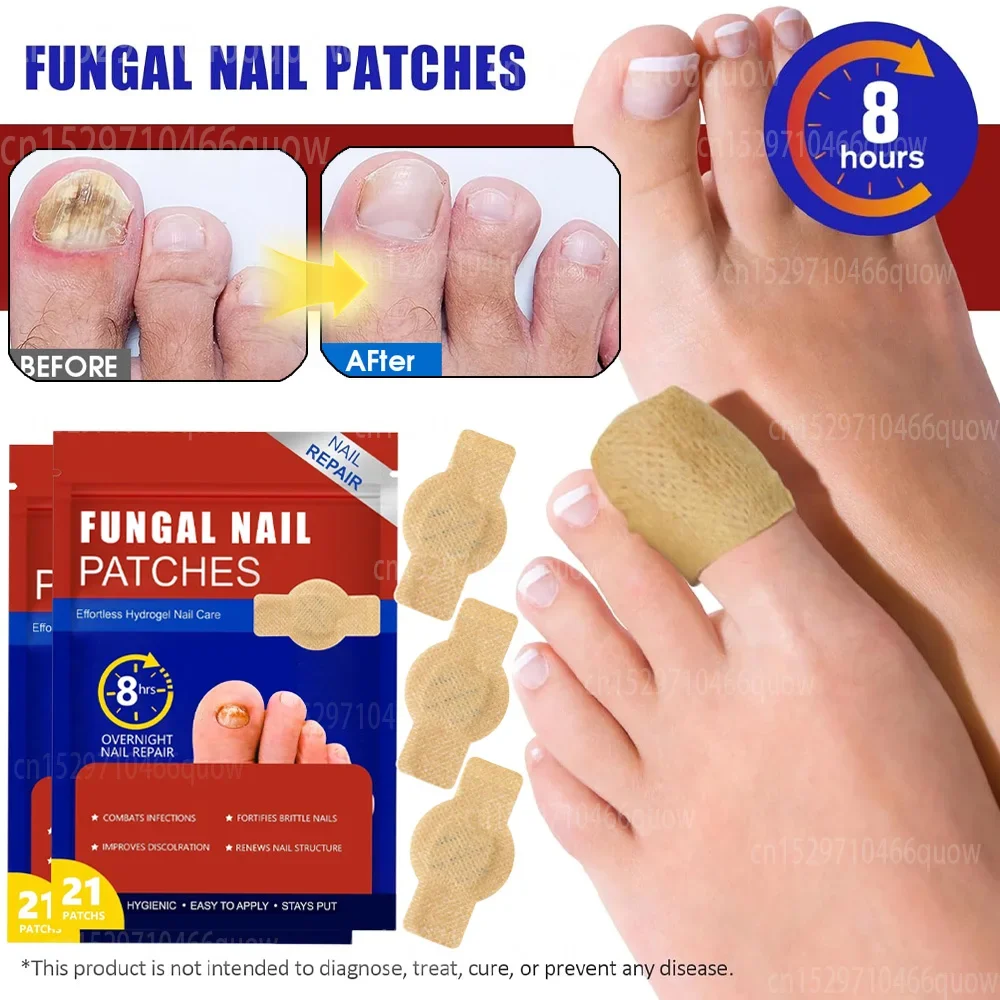 Toenail Fungus Treatment Stick - Nail Art Remove review and price