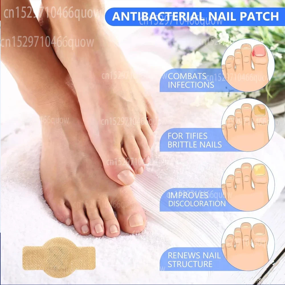 Toenail Fungus Treatment Stick - Nail Art Remove review and price