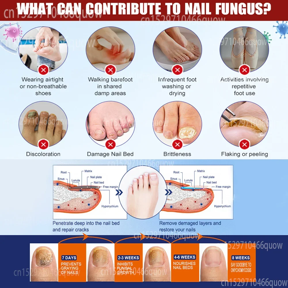 Toenail Fungus Treatment Stick - Nail Art Remove review and price